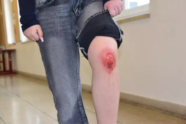 Eine täuschend echte Verletzung für den Erste Hilfe Kurs. | Foto: Preineder