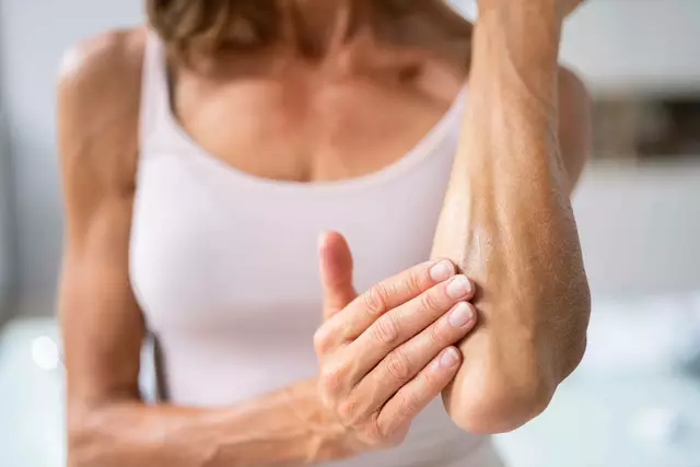 Bestimmte Bakterien können dabei helfen, sich in der eigenen Haut wieder wohlzufühlen. | Foto: Panthermedia