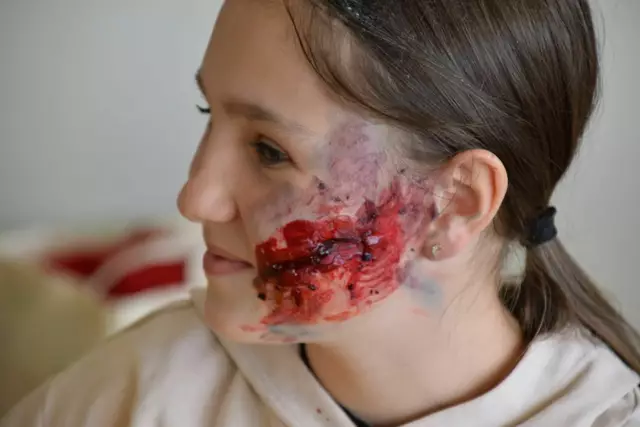 41 Figurant:innen mit realistisch dargestellten Verletzungsmustern | Foto: Rotes Kreuz Salzburg