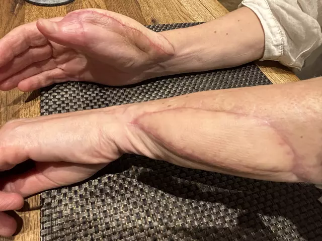 Susi S. wurde im August des Vorjahres von einem Hund gebissen. Der Alltag ist für sie mehr als leidvoll | Foto: Waltraud Fischer