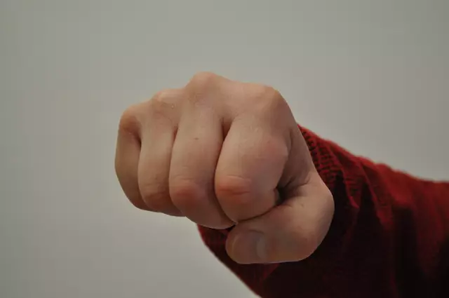 Hintergrund unklar: Warum der Angriff geschah, ist Gegenstand der laufenden Ermittlungen. | Foto: Archiv (Symbolbild)