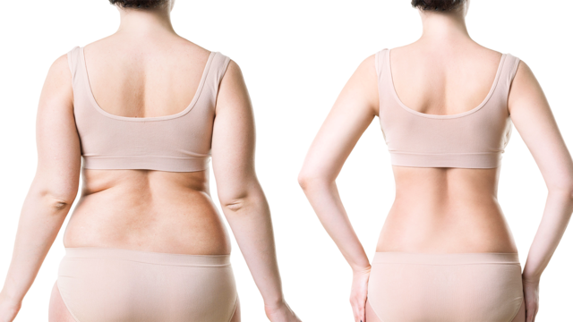 Mit einem individuell abgestimmten Programm, das dem Stoffwechsel unter die Arme greift, können Gewicht und lästige Fettpölsterchen erfolgreich reduziert werden.