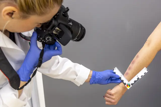 In der Gewaltambulanz werden Verletzungen auch dokumentiert. In Graz geschieht das bereits seit 2008, in Wien seit Jänner 2025. Das Angebot wird auf Niederösterreich ausgeweitet. | Foto: Med Uni Graz/Lunghammer