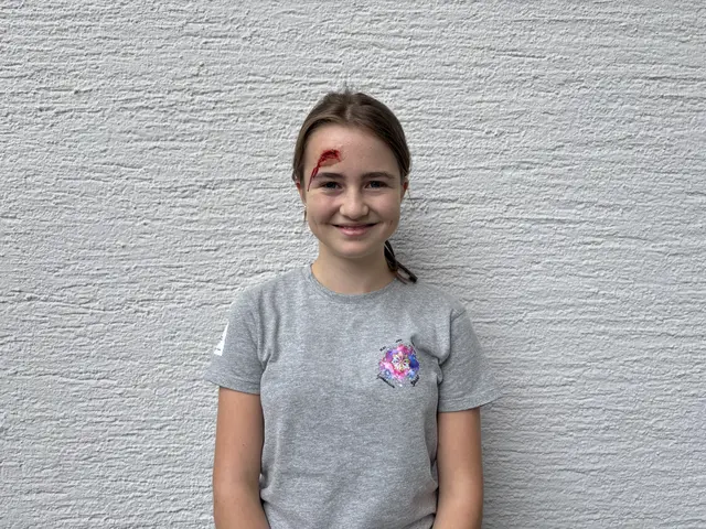 Eine junge Statistin mit Wunde am Kopf. | Foto: MeinBezirk