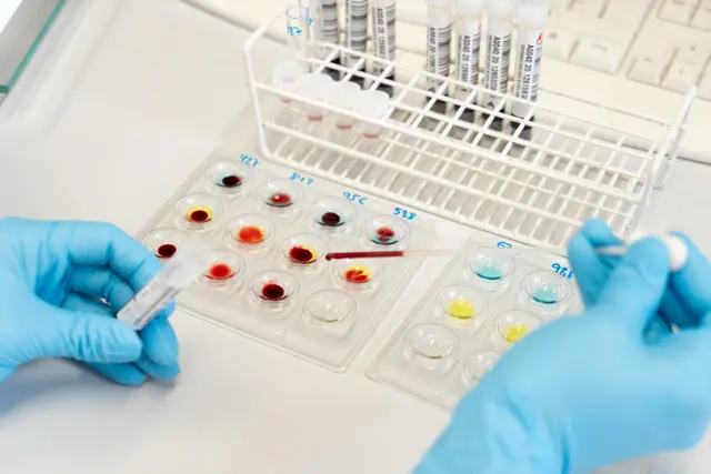 Jede Blutspende wird untersucht und die Spender:innen erhalten eine Auswertung. | Foto: Österreichisches Rotes Kreuz