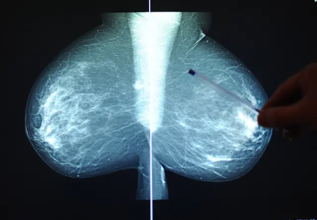 Zwei Jahre nach einer Krebsdiagnose sind 77 Prozent der Betroffenen wieder berufstätig.(Symbolfoto) | Foto: APA/Gindl/Themenbild