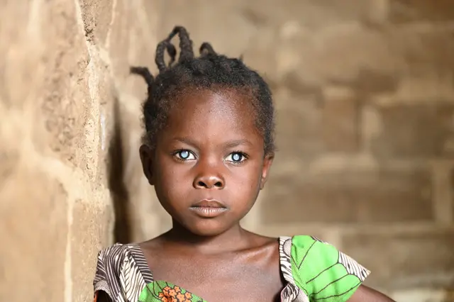 Die achtjährige Valentine aus Kamerun ist durch die Augenkrankheit Grauer Star erblindet. | Foto:  CBM