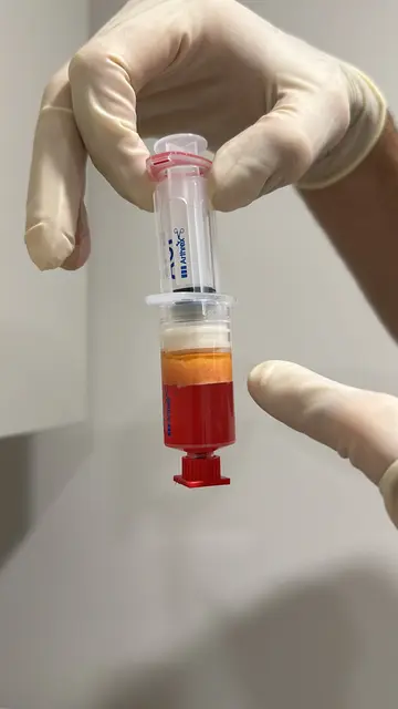 Stammzellen fördern die Regeneration geschädigter Gewebe, regulieren Entzündungen und unterstützen die natürliche Heilung des Körpers. | Foto: healthdoctors