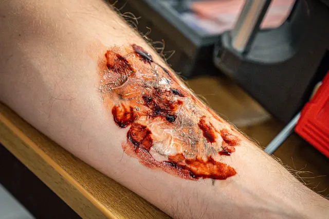 Foto: Hubert Wilflingseder/BFK LL