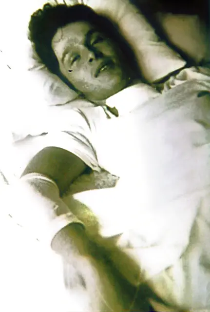 Das erste Foto nach Paulus Ploier`s Unfall im Jahre 1984, aufgenommen im REHA-Zentrum Bad Häring, nachdem die künstliche Beatmung circa 4 bis 5 Monate nach dem Unfall beendet wurde und die Sprechkanüle entfernt wurde. Er war zu diesem Zeitpunkt komplett unbeweglich. Er konnte zu diesem Zeitpunkt nur den Kopf bewegen, Arme und Schultern waren noch komplett gelähmt. | Foto: Archiv Paulus Ploier Privat