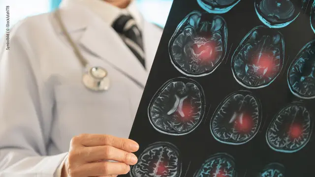 Foto: iStock/utah778