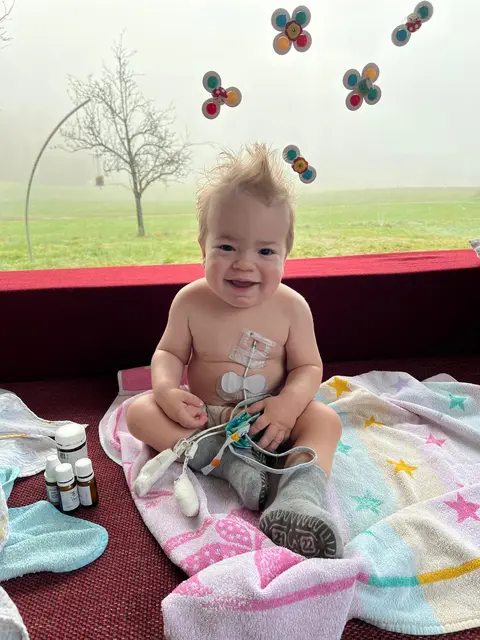 Eine weitere Hürde in Antons Leben: Schläuche, die im Brustbereich befestigt sind.  | Foto: Wollendorfer