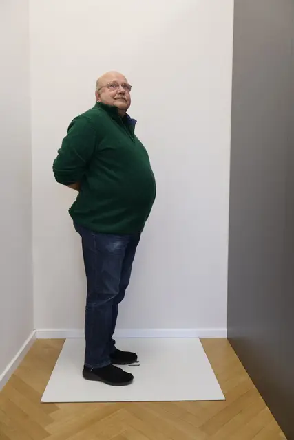Deutlich sichtbar: Der Bauch war seine größte Problemzone – Beweglichkeit und Lebensfreude litten darunter.