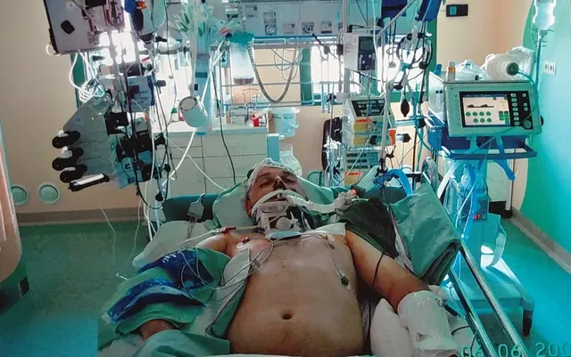 Geri lag zwei Monate im Koma und verlor dabei 30 Kilogramm | Foto: privat