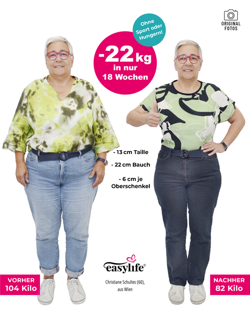 Vorher belastend, heute befreit – besonders am Bauch ist der Unterschied deutlich.