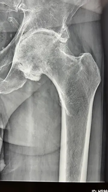 [Anzeige] Gelenks-Operationen durch richtige Therapie vermeiden