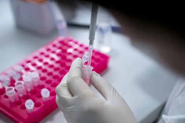 Foto: Confidence DNA-Analysen