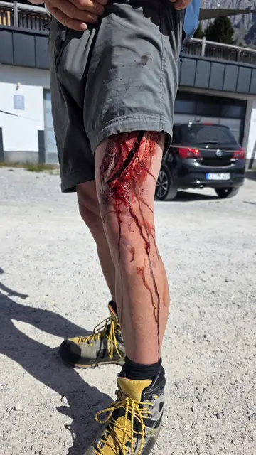 Es handelt sich nicht um eine echte Verletzung, sondern nur eine nachgestellte Wunde. | Foto: Kremser, Gamsjäger, Außerhofer