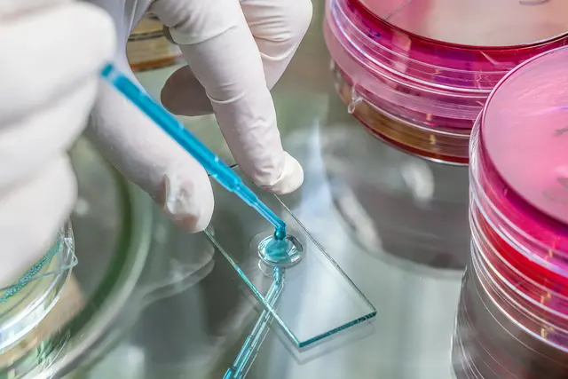  Die zuständige Behörde des Magistrats Linz arbeitet mit Hochdruck an der Abklärung der gehäuft auftretenden Legionelleninfektionen. Die Untersuchungen werden jedoch einige Tage in Anspruch nehmen. | Foto: photographee.eu/smarterpix
