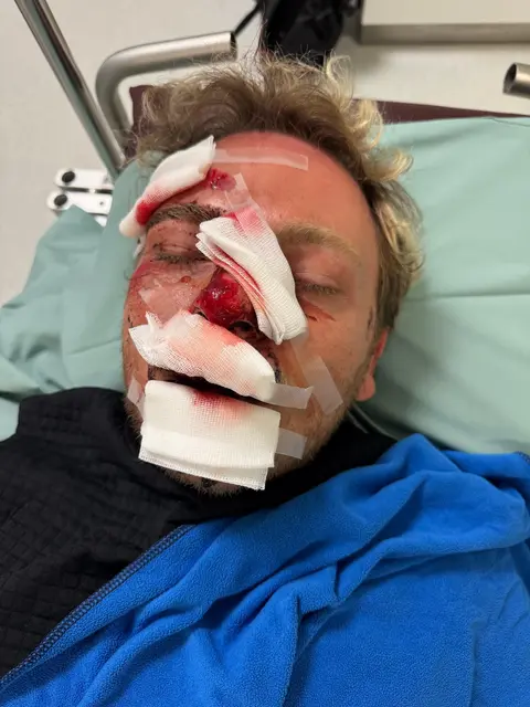 Der Unfall am 28. Juni 2026 richtete Michael Kleinheiz ordentlich zu. | Foto: Kleinheinz