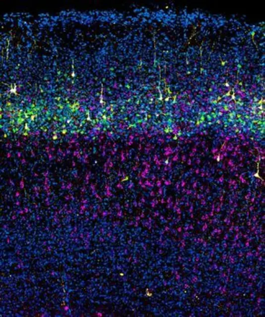 Projektionsneuronen in der Großhirnrinde der Maus. Intra-telencephale Projektionsneuronen (IT-PNs) sind in Magenta dargestellt. Neuronen, die während der späten Neurogenese entstanden sind, sind grün dargestellt. Gelb markiert sind pyramidale Projektionsneuronen, deren entwicklungsbedingter Ursprung und deren Vielfalt in dieser Studie untersucht wurden. | Foto: Irene Varela-Martínez/CNB-CSIC