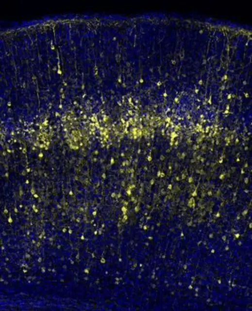 Auf den Spuren der Ursprünge kortikaler Neuronen. Gelb markiert sind Neuronen in der sich entwickelnden Großhirnrinde einer Maus, die durch Elektroporation im Mutterleib markiert wurden. Durch das Einbringen ausgewählter Gene in neurale Stammzellen vor der Geburt können Forscher:innen die aus diesen Vorläuferzellen entstehenden Neuronen verfolgen. Die Zellkerne sind blau dargestellt. | Foto: Varela-Martínez et al. / Science Advances