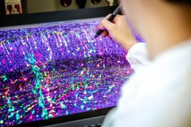 MADM-Technik. Mithilfe von MADM (Mosaic Analysis with Double Markers) lassen sich Neuronen in vivo (im lebenden Organismus), in der Maus, verfolgen und ihre Abstammung rekonstruieren. | Foto: Nadine Poncioni / ISTA