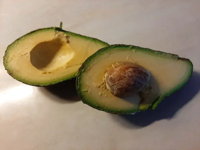 Die sogenannte „Avocado-Hand“ sorgt derzeit für Schlagzeilen.