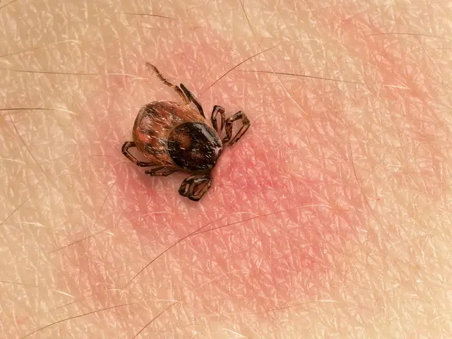 Ein Zeckenstich bleibt häufig unbemerkt, da er in der Regel schmerzlos ist. | Foto: Smileus/smarterpix