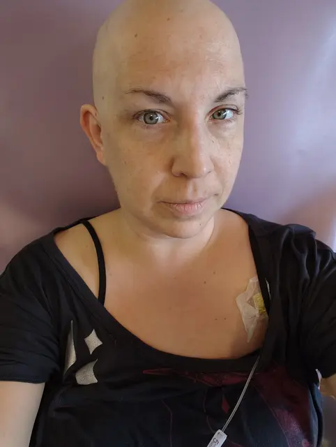 Während einer Chemo-Sitzung. | Foto: Eva Lacher-Dörfler