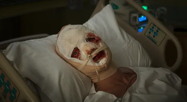 Tom Rhys Harries als schwer verletzter Matt Hagen | Foto: Photo Courtesy Warner Bros. Pictures