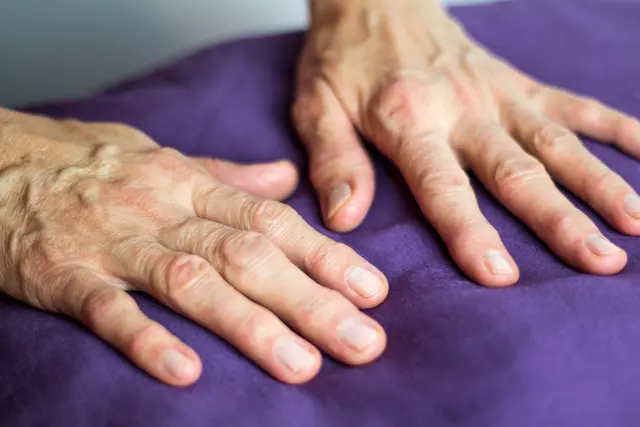 Der Rheumatag findet am 22. September in Innsbruck, Kufstein und Zams statt.  | Foto: Archiv